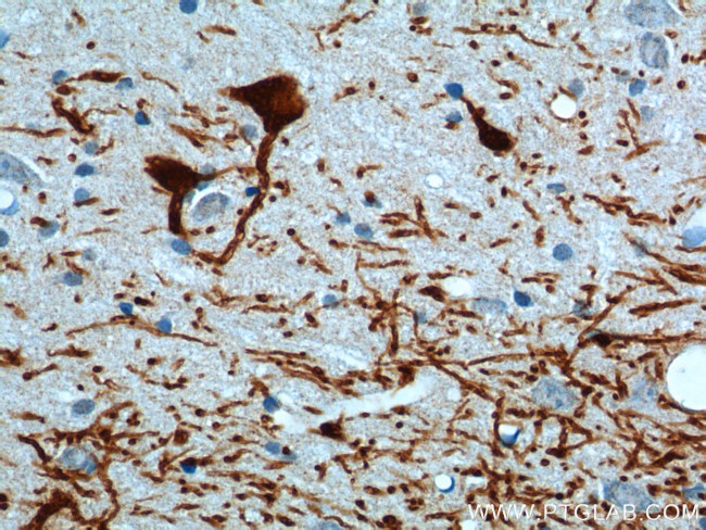 TH Antibody in Immunohistochemistry (Paraffin) (IHC (P))