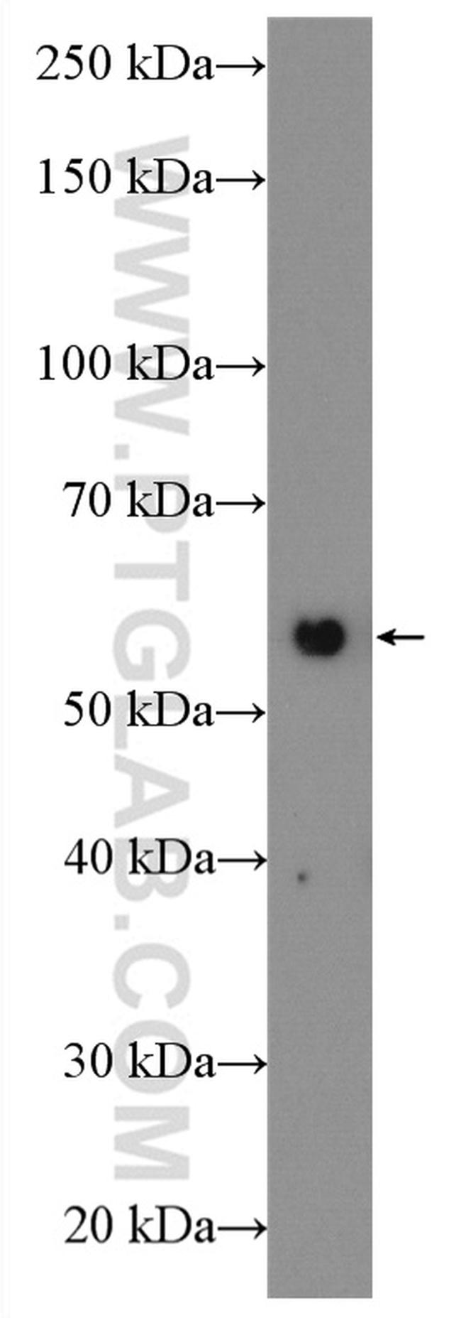 TH Antibody in Western Blot (WB)