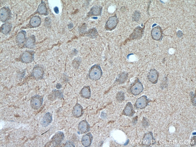 GALNT9 Antibody in Immunohistochemistry (Paraffin) (IHC (P))