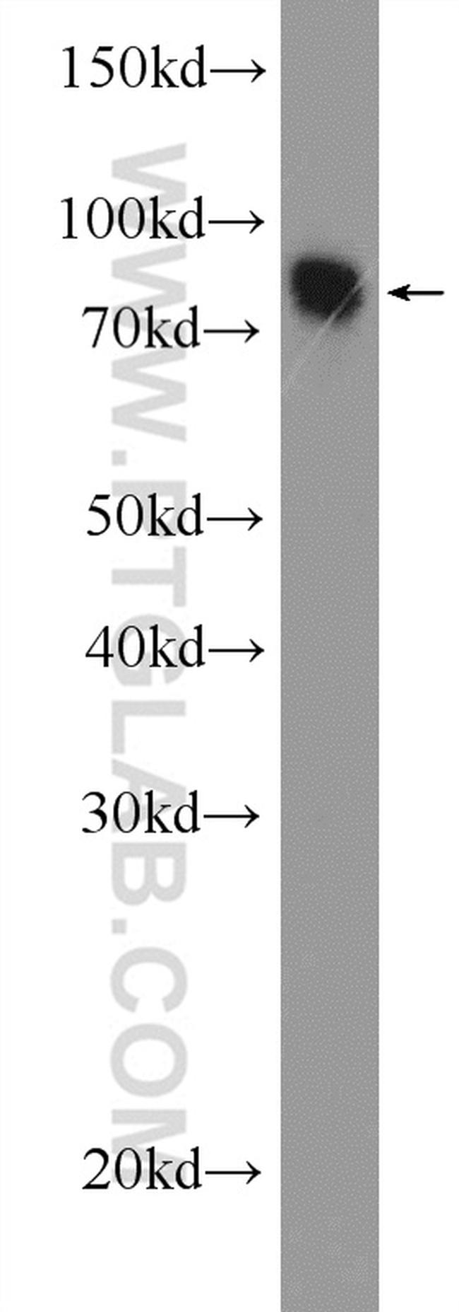 MTMR7 Antibody in Western Blot (WB)