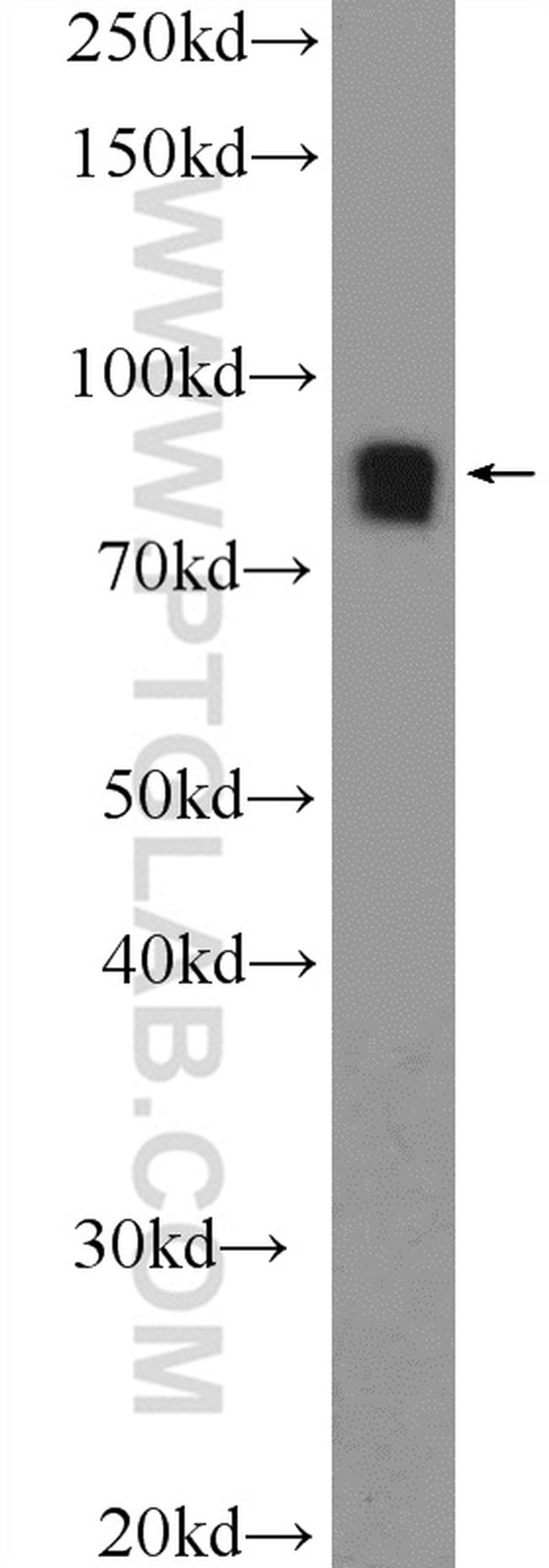 MTMR7 Antibody in Western Blot (WB)