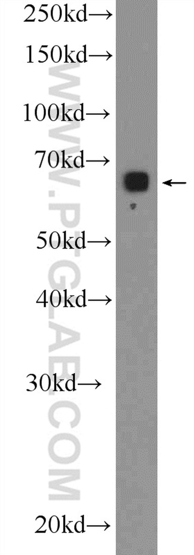 GLT25D2 Antibody in Western Blot (WB)