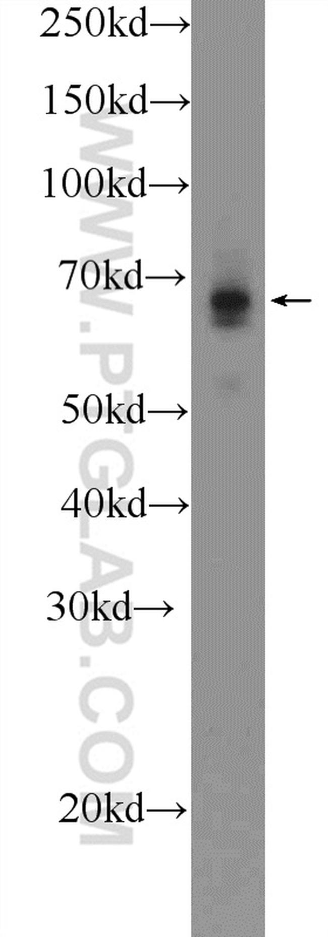 GLT25D2 Antibody in Western Blot (WB)