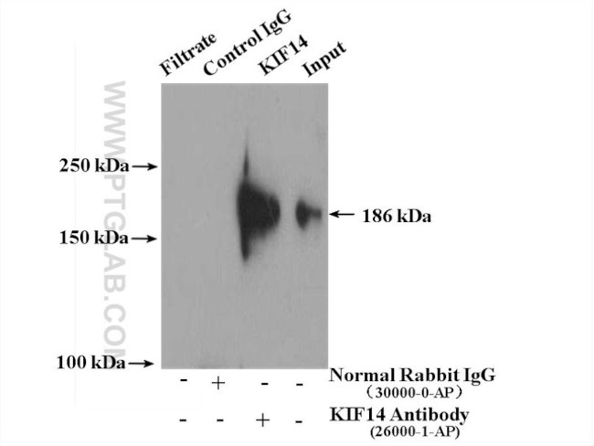 KIF14 Antibody in Immunoprecipitation (IP)