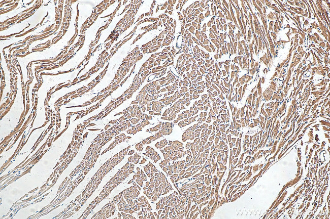 DHRS7C Antibody in Immunohistochemistry (Paraffin) (IHC (P))