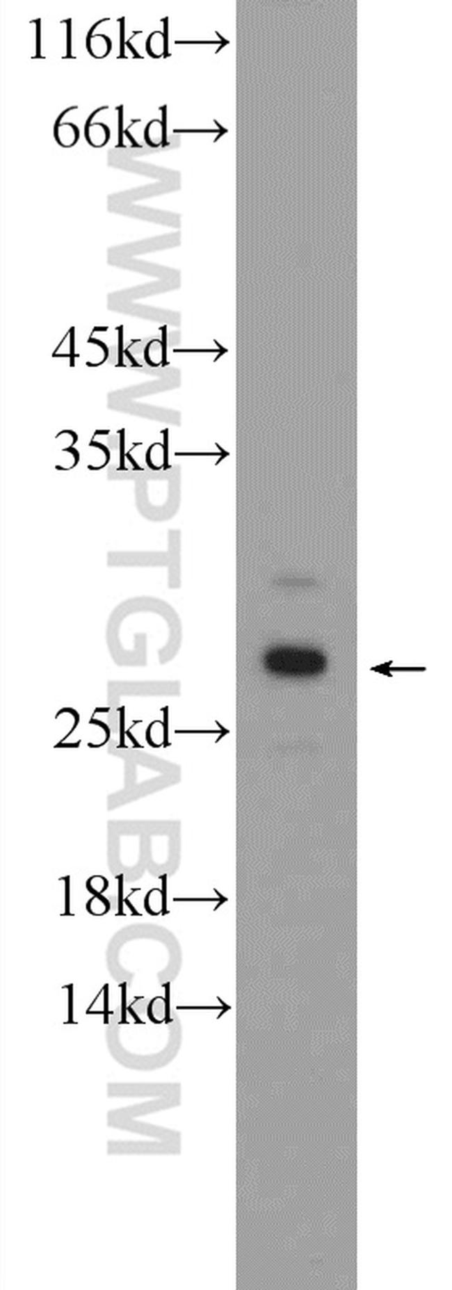LOC123688 Antibody in Western Blot (WB)