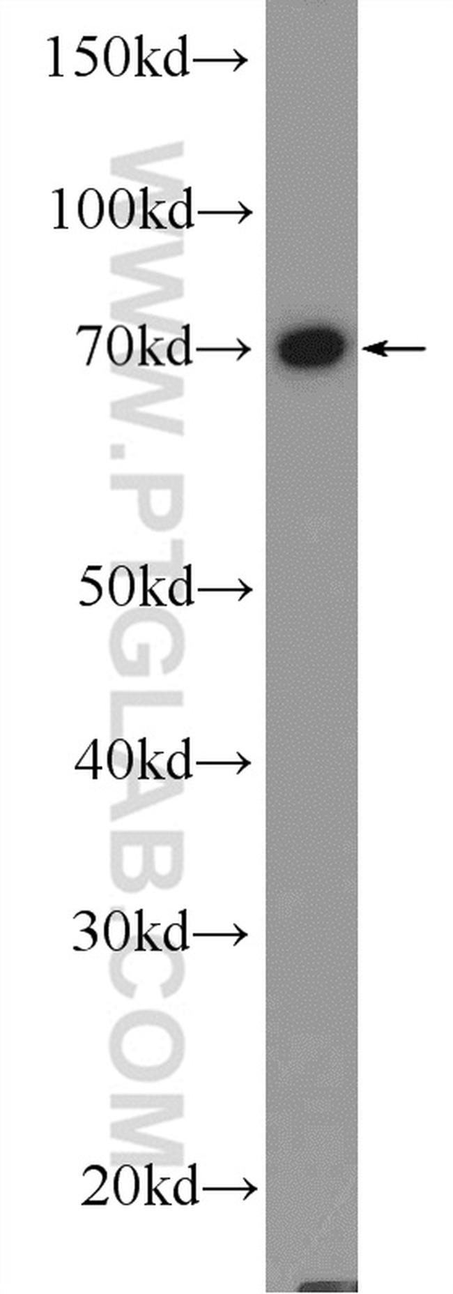 RDX Antibody in Western Blot (WB)