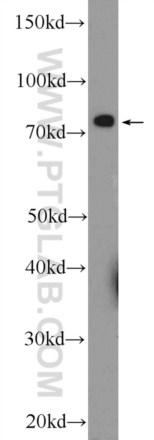 RDX Antibody in Western Blot (WB)