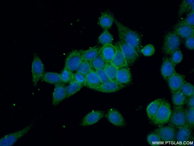 RDX Antibody in Immunocytochemistry (ICC/IF)