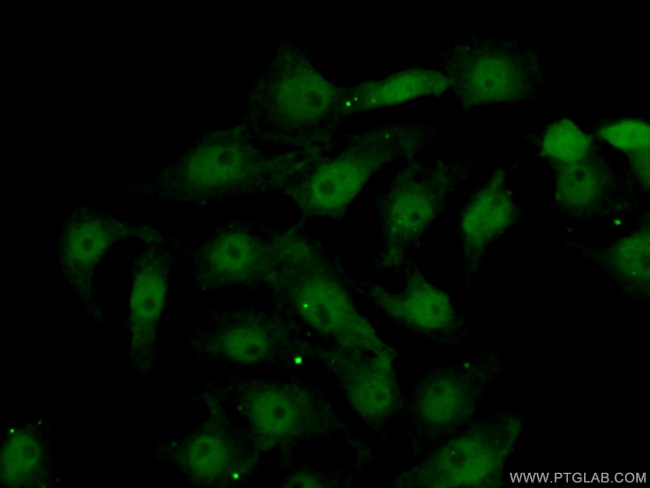 DLX2 Antibody in Immunocytochemistry (ICC/IF)