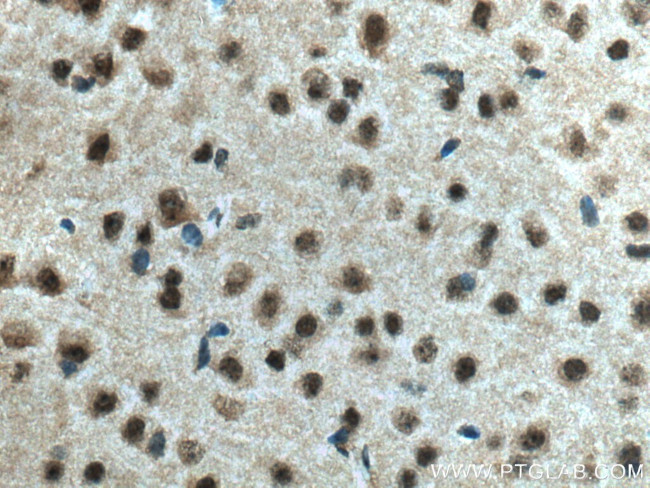 DLX2 Antibody in Immunohistochemistry (Paraffin) (IHC (P))