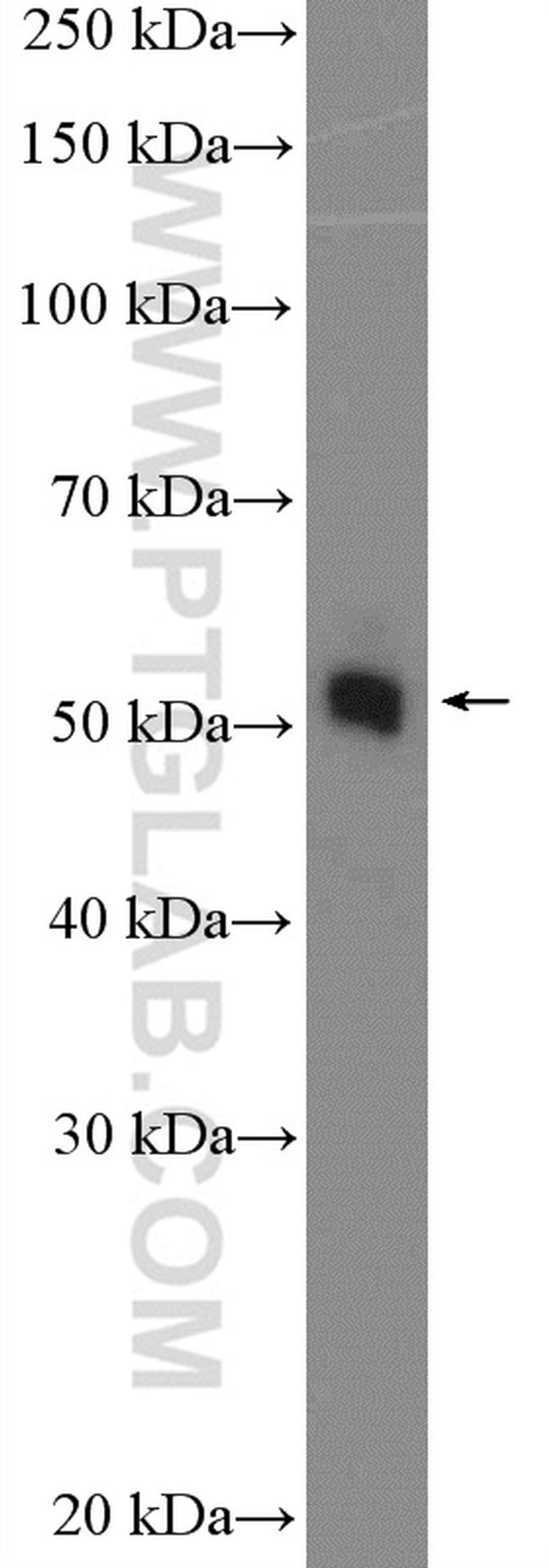 CCM2 Antibody in Western Blot (WB)