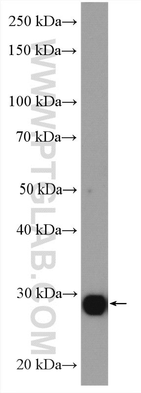 CBX7 Antibody in Western Blot (WB)