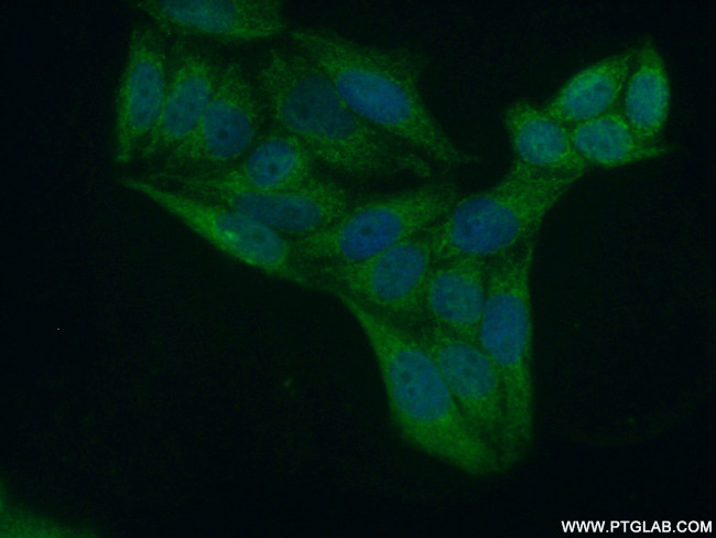 ZNF385A Antibody in Immunocytochemistry (ICC/IF)