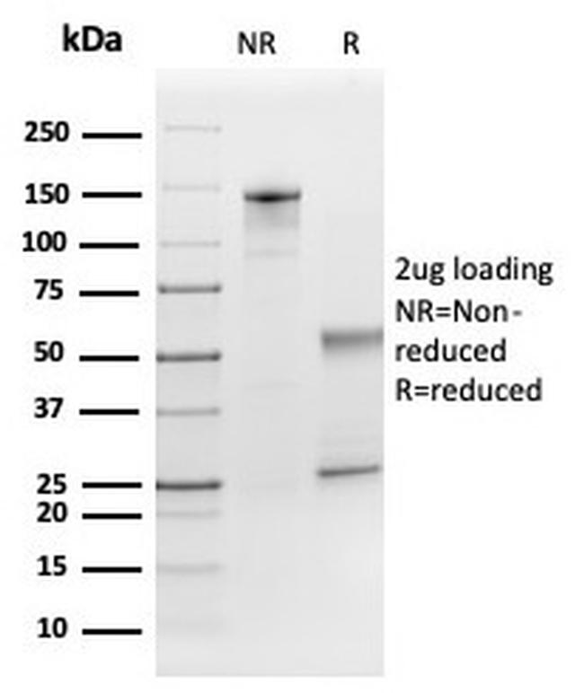 FGF21 (Fibroblast growth factor 21) Antibody in SDS-PAGE (SDS-PAGE)