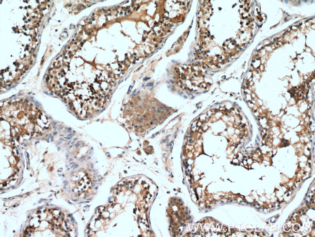 PDILT Antibody in Immunohistochemistry (Paraffin) (IHC (P))