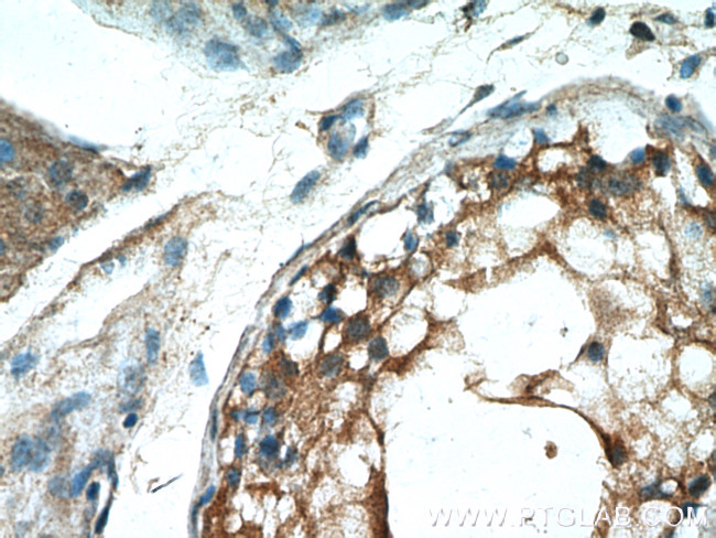 PDILT Antibody in Immunohistochemistry (Paraffin) (IHC (P))