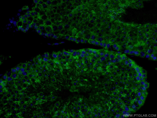 PDILT Antibody in Immunohistochemistry (PFA fixed) (IHC (PFA))