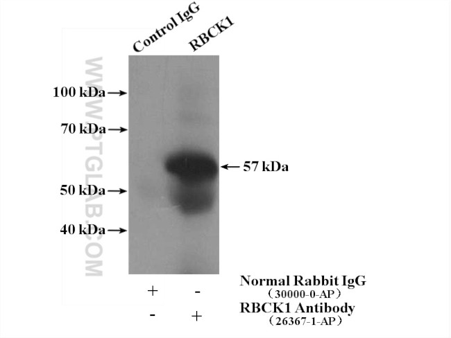 RBCK1 Antibody in Immunoprecipitation (IP)