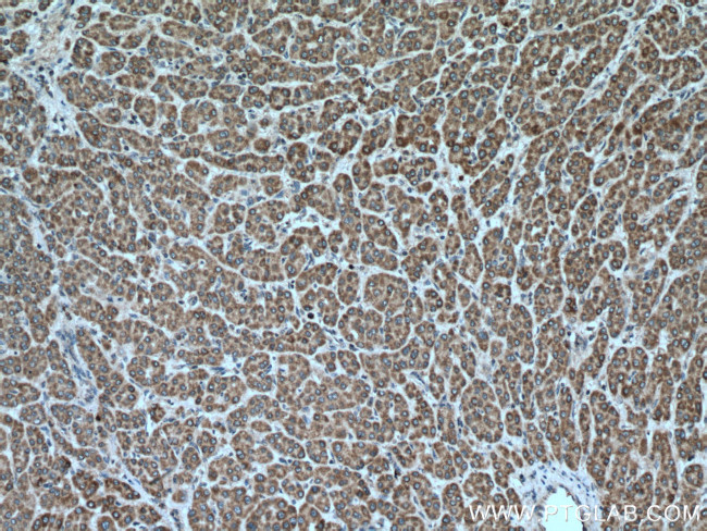 VEGFA Antibody in Immunohistochemistry (Paraffin) (IHC (P))