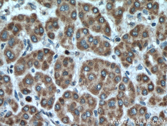 VEGFA Antibody in Immunohistochemistry (Paraffin) (IHC (P))