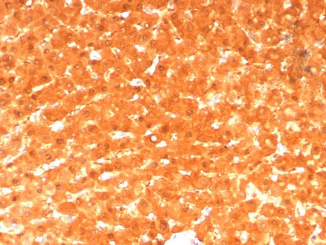 GCHFR Antibody in Immunohistochemistry (Paraffin) (IHC (P))