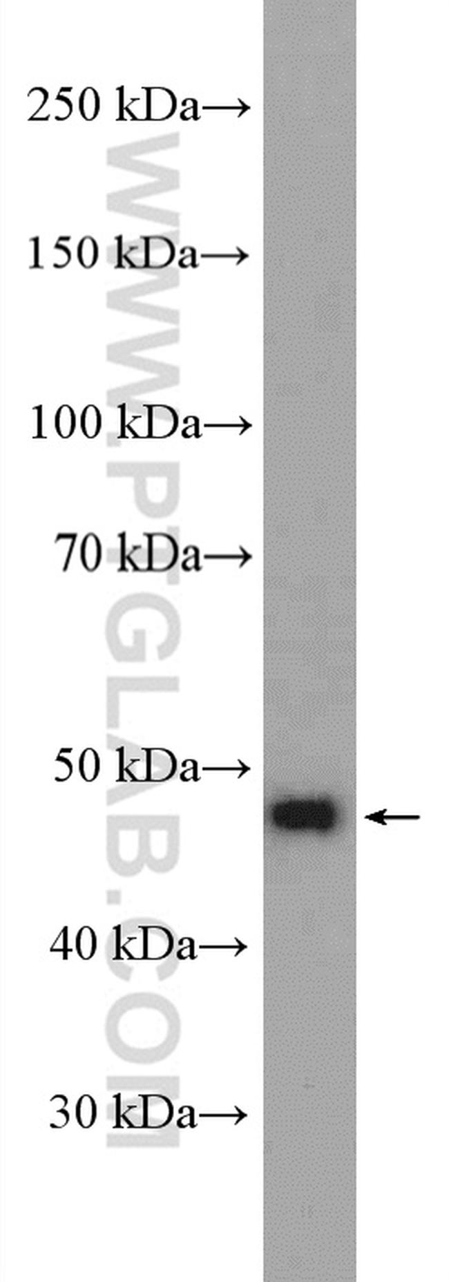 GALR2 Antibody in Western Blot (WB)