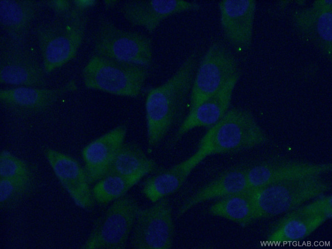 MC1R Antibody in Immunocytochemistry (ICC/IF)