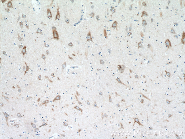 MC1R Antibody in Immunohistochemistry (Paraffin) (IHC (P))