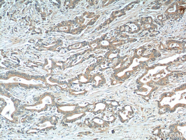 MIP-3 alpha Antibody in Immunohistochemistry (Paraffin) (IHC (P))