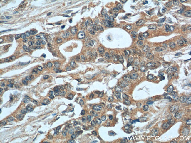 MIP-3 alpha Antibody in Immunohistochemistry (Paraffin) (IHC (P))