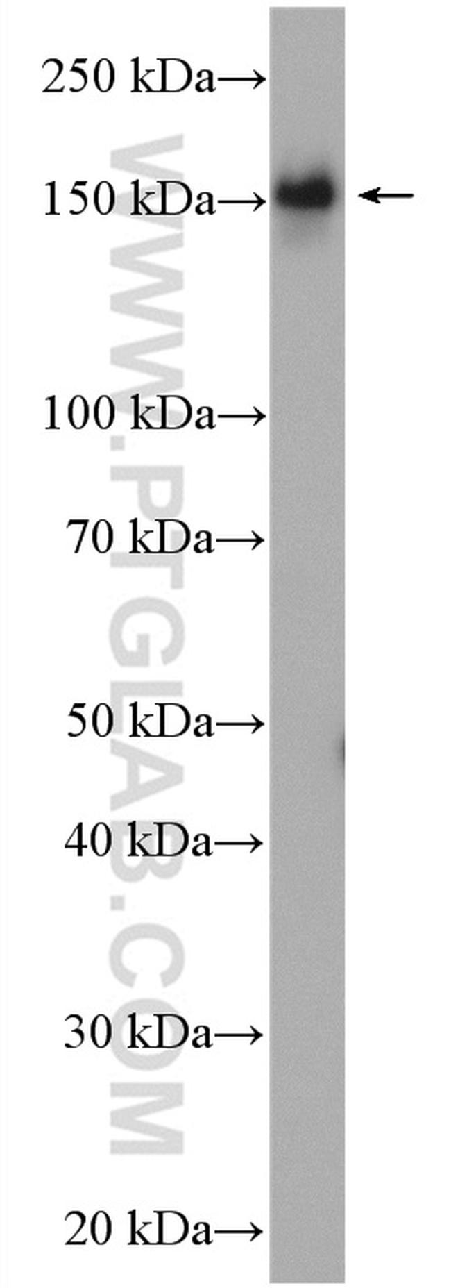 53BP2 Antibody in Western Blot (WB)