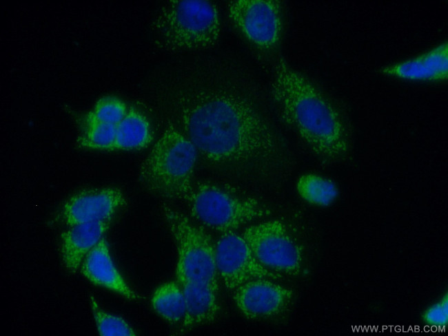 FGF9 Antibody in Immunocytochemistry (ICC/IF)