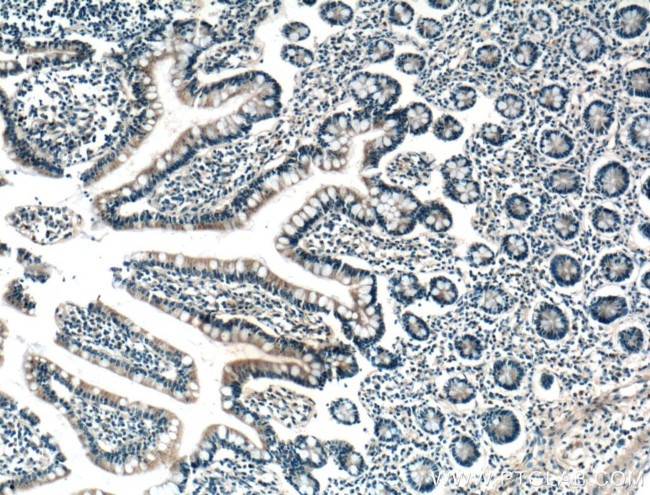 FGF9 Antibody in Immunohistochemistry (Paraffin) (IHC (P))