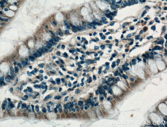 FGF9 Antibody in Immunohistochemistry (Paraffin) (IHC (P))