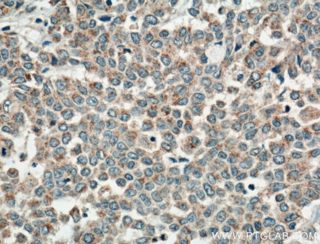 FGF9 Antibody in Immunohistochemistry (Paraffin) (IHC (P))