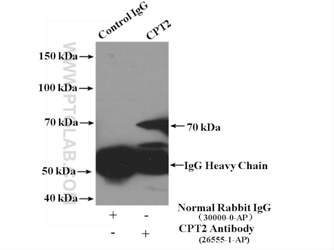 CPT2 Antibody in Immunoprecipitation (IP)