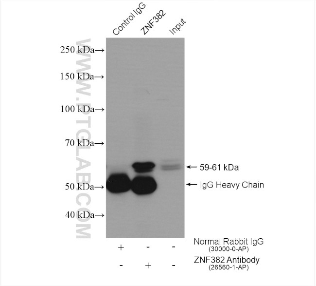 ZNF382 Antibody in Immunoprecipitation (IP)