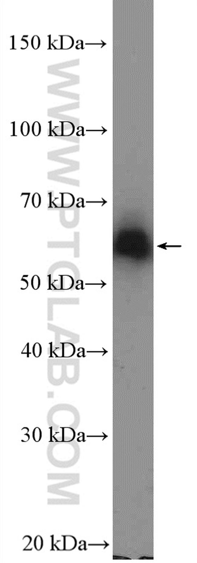 ZNF382 Antibody in Western Blot (WB)