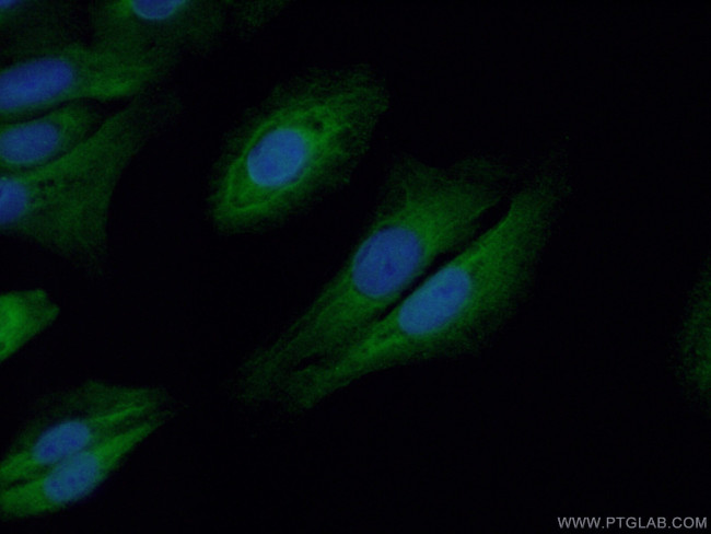 C22orf33 Antibody in Immunocytochemistry (ICC/IF)