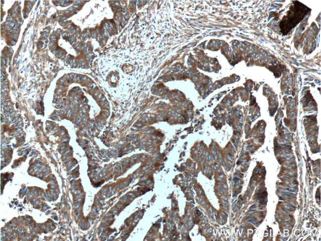 ST13 Antibody in Immunohistochemistry (Paraffin) (IHC (P))