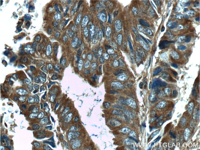 ST13 Antibody in Immunohistochemistry (Paraffin) (IHC (P))