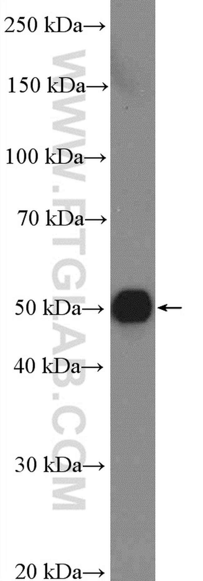 ST13 Antibody in Western Blot (WB)