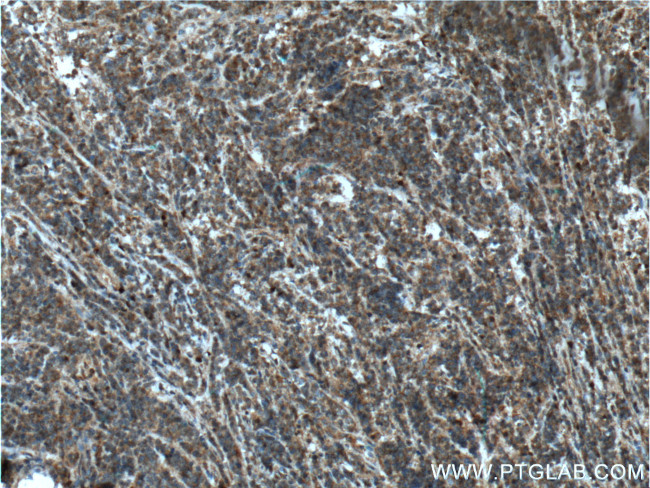 STK17B Antibody in Immunohistochemistry (Paraffin) (IHC (P))