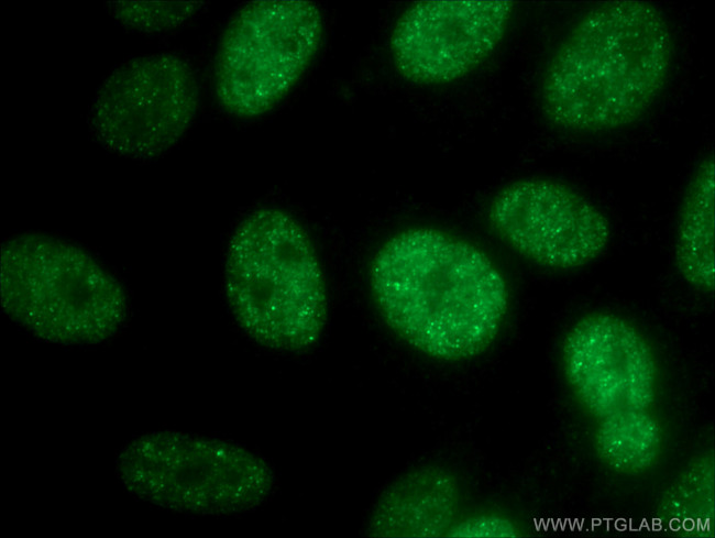 SMARCA2 Antibody in Immunocytochemistry (ICC/IF)