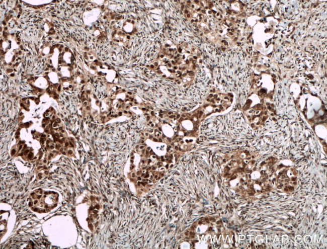 SMARCA2 Antibody in Immunohistochemistry (Paraffin) (IHC (P))