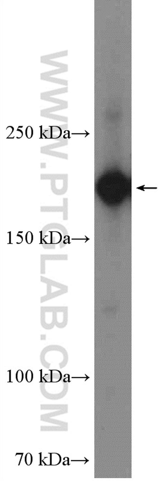 SMARCA2 Antibody in Western Blot (WB)