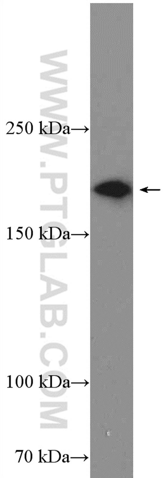 SMARCA2 Antibody in Western Blot (WB)