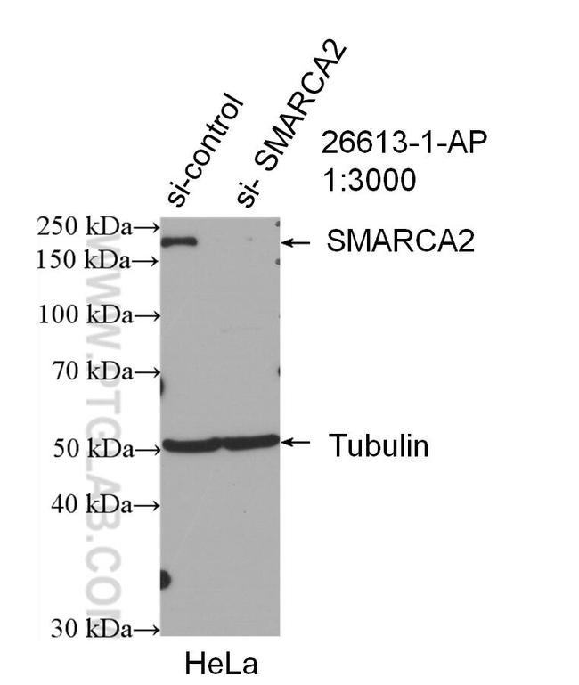 SMARCA2 Antibody in Western Blot (WB)