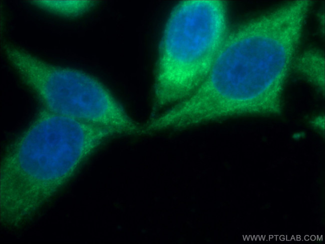 ALDH9A1 Antibody in Immunocytochemistry (ICC/IF)